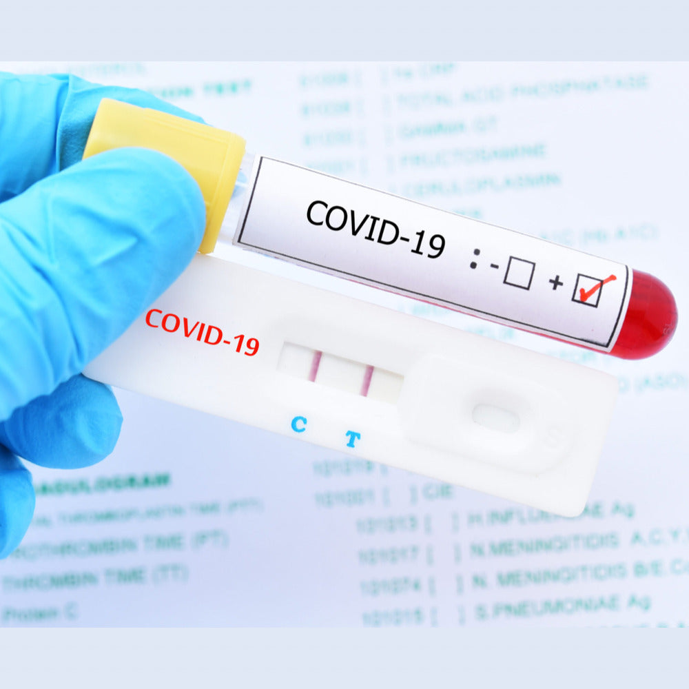 Análisis de Chlamidia IgG/IgM | Laboratorio Technolab