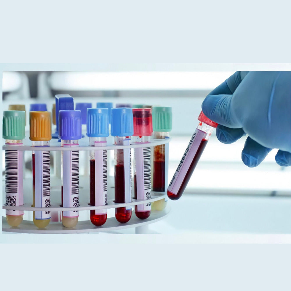 Análisis de COVID 19 ELISA | Laboratorio Technolab