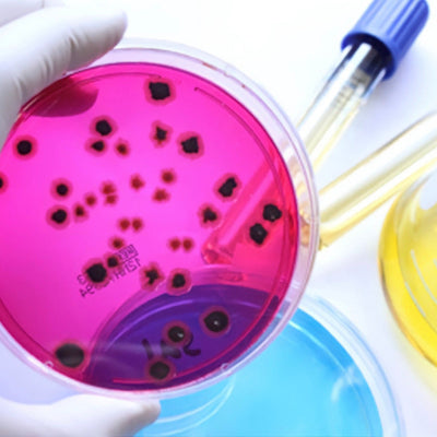 Análisis Antigeno Helicobacter Pylori | Laboratorio Technolab