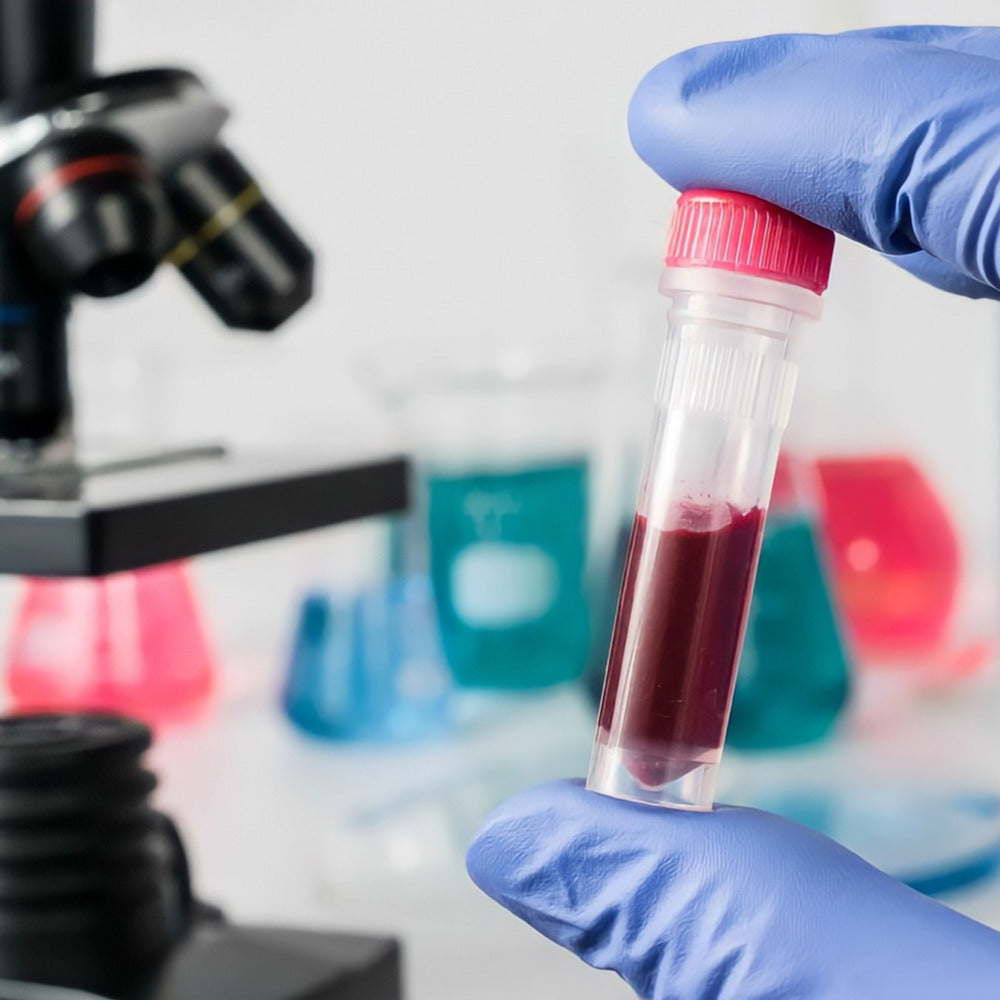 Análisis de Colesterol HDL | Laboratorio Technolab